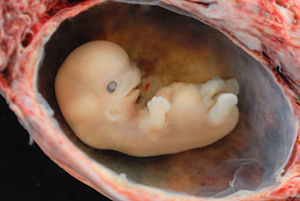 abortus