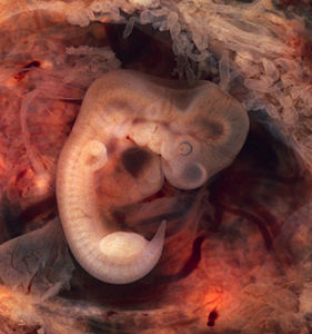 Embriyoner