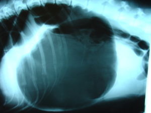 Gastric dilatation volvulus